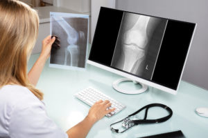 Radiology Malpractice