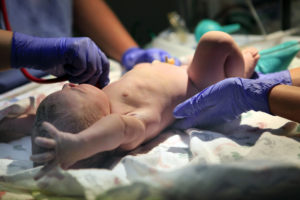 Birth Injuries Caused by Hypoxia