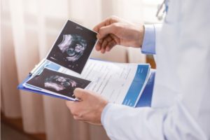 Fetal Monitoring Errors and Birth Injuries