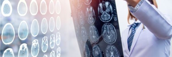 Understanding the Impact of Traumatic Brain Injuries
