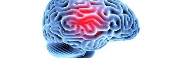 Common Causes of Traumatic Brain Injury