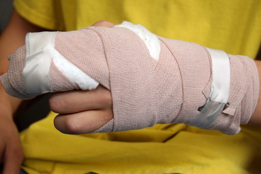 Understanding Burn Injuries